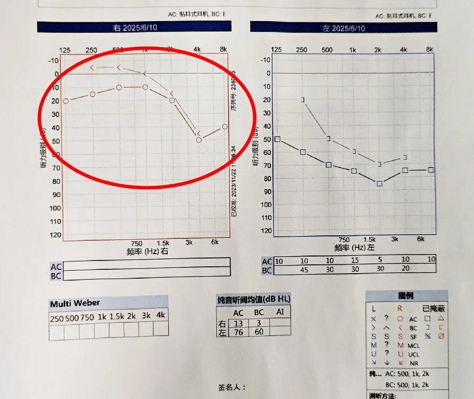 听力干货篇：听力检测报告怎么看？_川芎_来自小红书网页版 拷贝.jpg